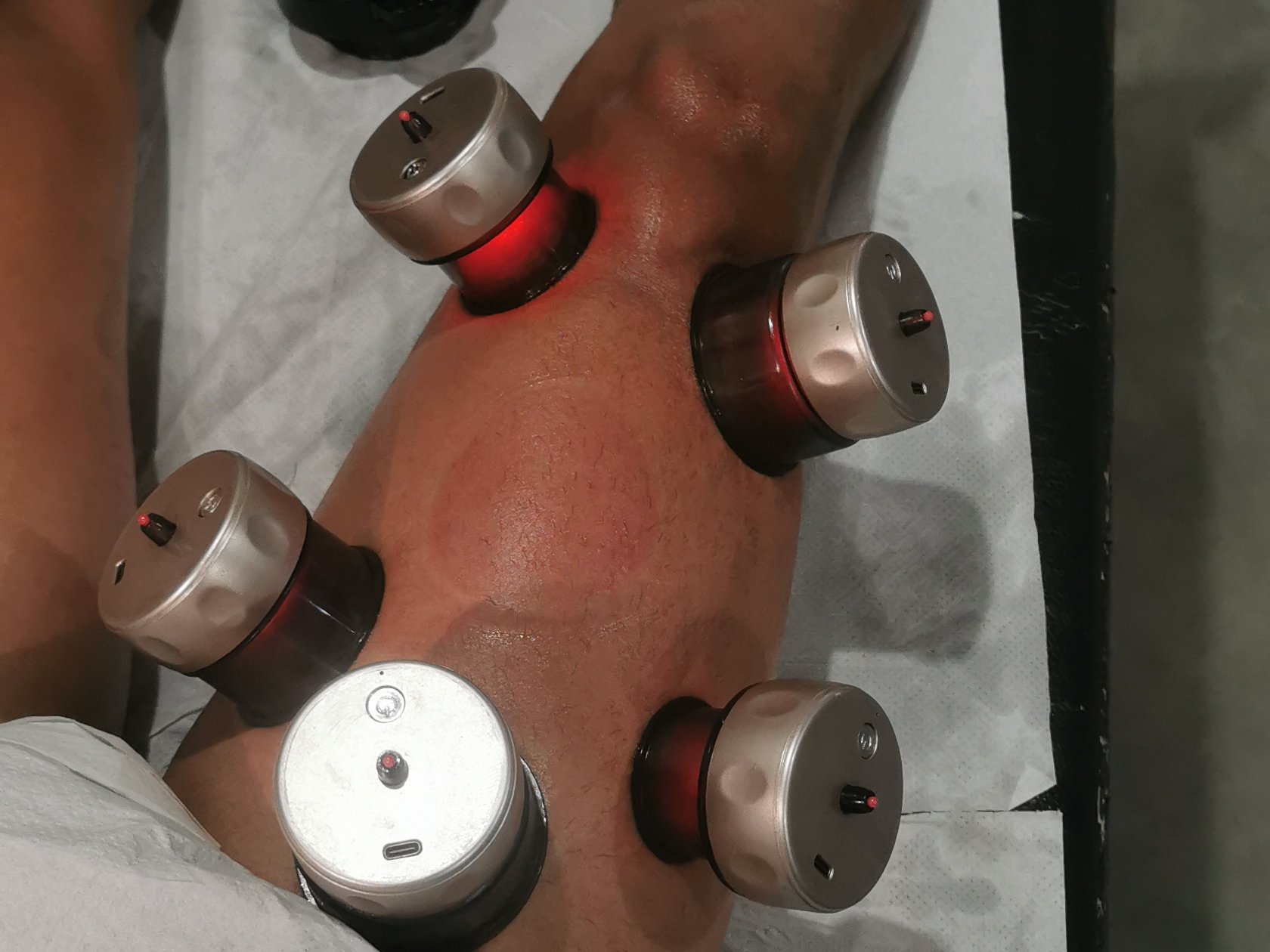 Hijama et massage thérapeutique - Photo 2