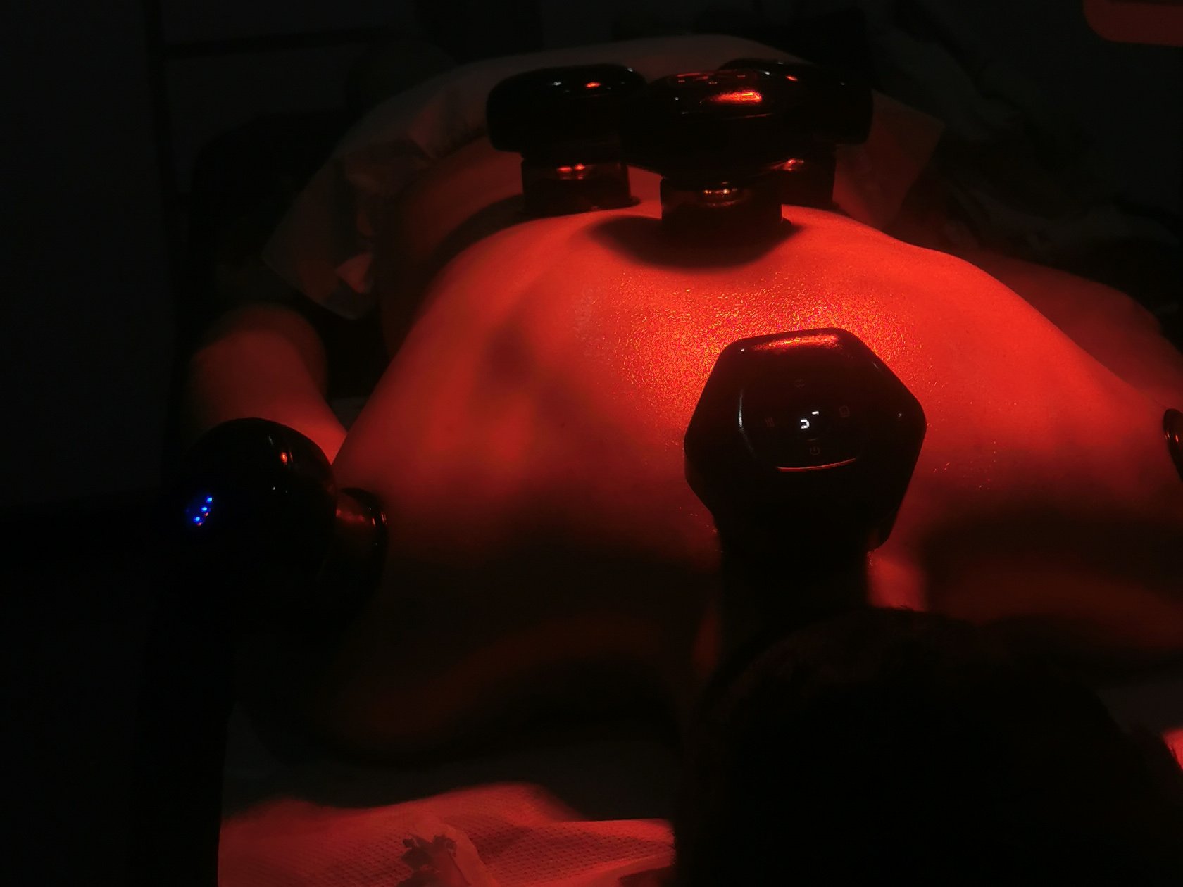 Hijama et massage thérapeutique - Photo 3